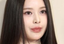 IZNA Bang Jimin’in burun estetiği