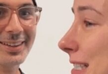 Gördüğüm en iyi burun estetiği