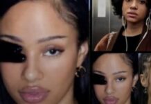 Manon dudak dolgusu mu yaptırdı?